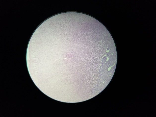 Adrenal Slides - Adrenal 003 100X